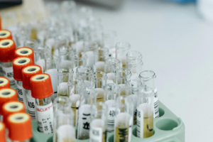 Médicos curan de rara enfermedad a un bebé modificando su ADN 👶🏽🤱🏽